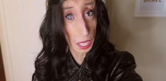 lizzie velasquez