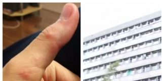 Un student dintr-un cămin din România a ajuns la spital din cauza ploșnițelor cămin ploșnițe