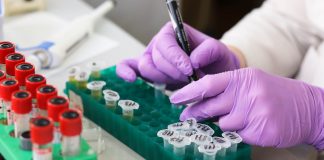 Alți 2 români au coronavirus. Numărul de îmbolnăviri a ajuns la 17 FOTO: Belova59/Pixabay.com