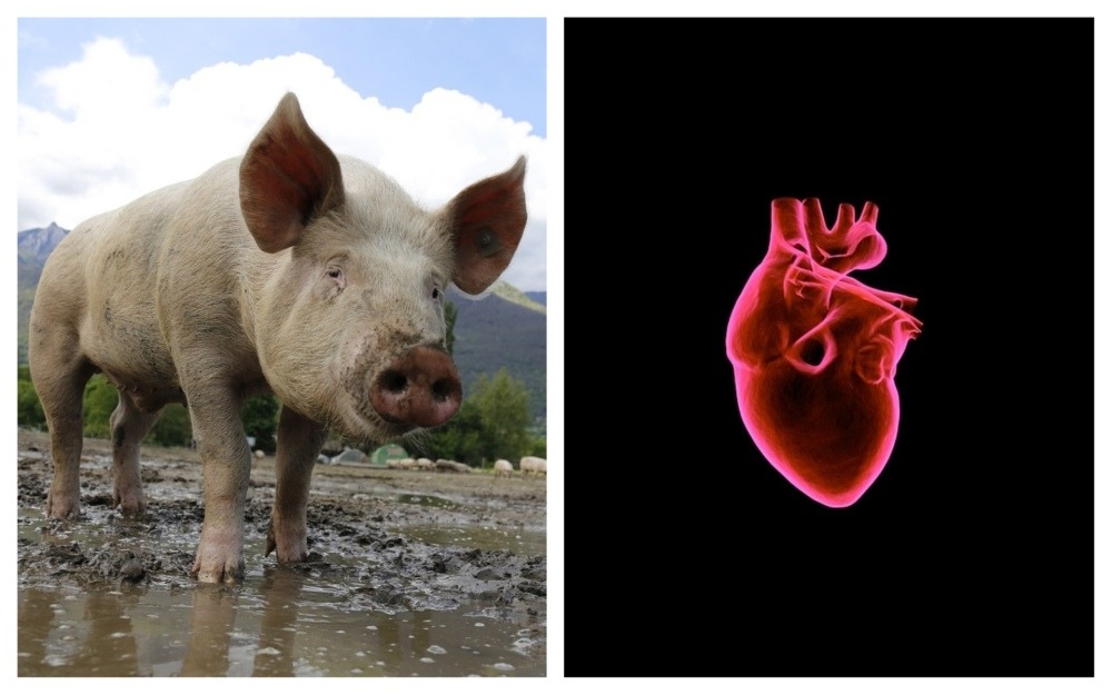 inimă transplant porc om