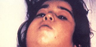 Alertă la graniță! A apărut o boală infecțioasă gravă: “A devenit o amenințare pentru România” difterie