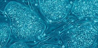Ce sunt celulele stem și la ce ajută. Terapia de succes folosită de 30 de ani ce sunt celulele stem și la ce ajută