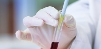 Încă un caz de coronavirus vindecat în România FOTO: Philippedelavie/Pixabay.com