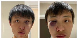 Atac rasist în Londra: “Nu vreau coronavirusul tău în țara mea” student singapore bătut londra