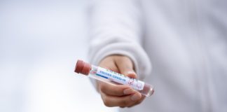 98% dintre pacienții tratați cu un medicament împotriva COVID-19 s-au vindecat test coronavirus