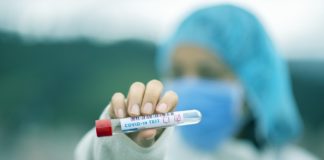 Teste de anticorpi pentru coronavirus, disponibile în România. Se fac la cerere test anticorpi coronavirus