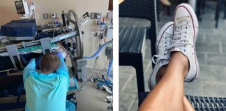 Un bărbat a ajuns în comă din cauza unui fir de păr crescut pe sub piele. Medicii i-au dat 4% șanse de supraviețuire picioare fir păr